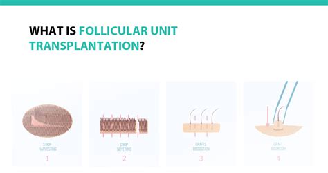 What Is Follicular Unit Transplantation Advanced Medical Hair