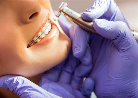 ¿cuáles Son Las Fases De Un Tratamiento De Ortodoncia Clínica Dental As Barcelona
