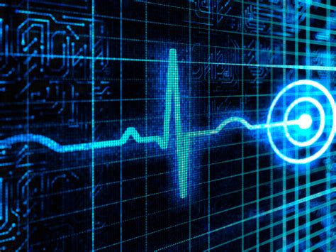 Free Flatline Ekg Cliparts Download Free Flatline Ekg Cliparts Png