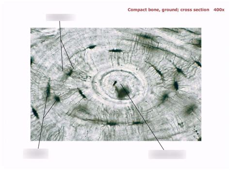 Compact Bone Ground Cross Section 400x Diagram Quizlet