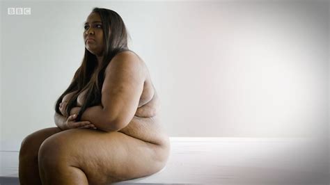 Naked Morbidly Obese Women Telegraph