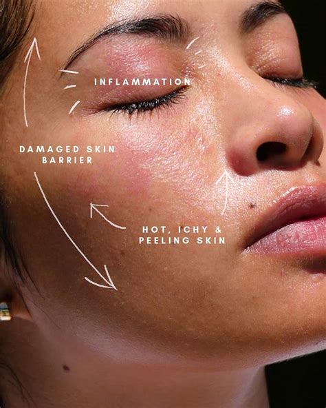 What Leads To A Damaged Skin Barrier Ways To Fix It