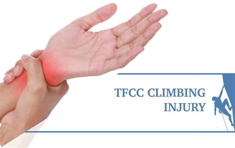 Tfcc Injury A Common Source Of Wrist Pain In Climbers The Climbing Doctor