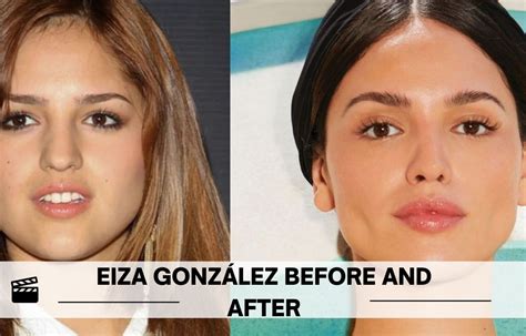 Eiza González Before And After Surgery Look Check Out Her Incredible