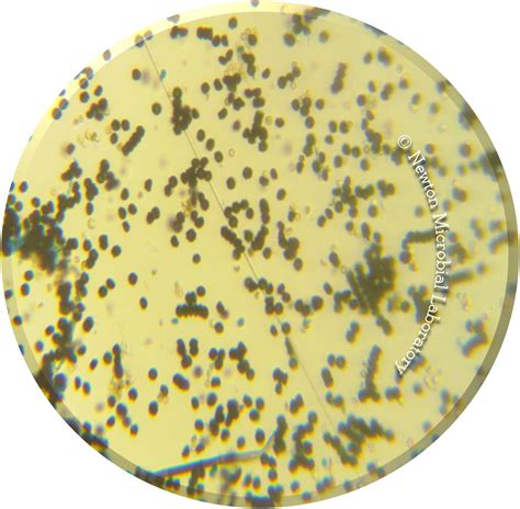 Maybe you would like to learn more about one of these? Black Mold Pictures, under the microscopes | Mold Awareness