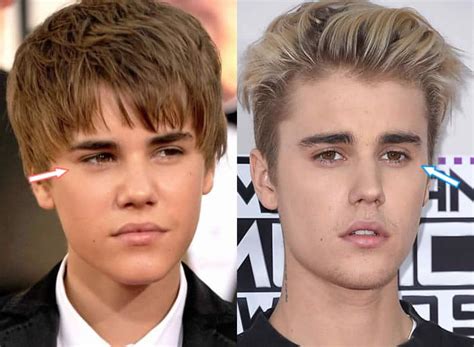 Justin Bieber Before And After Transformation 2018