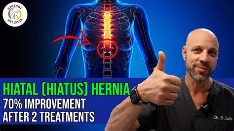 Hiatal Hiatus Hernia 70 Improvement After Hiatal Hernia Maneuver