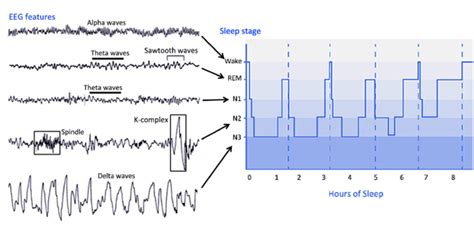 Eeg Features And Hypnogram Of Sleep Stages The Right Side Of The