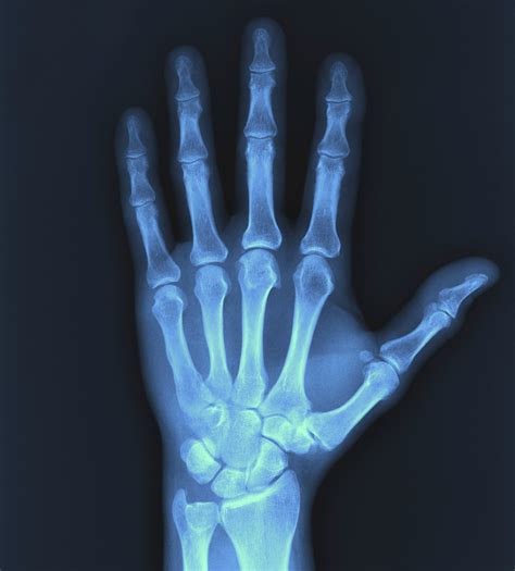 Written in html, css and javascript. The meaning and symbolism of the word - «X-ray»