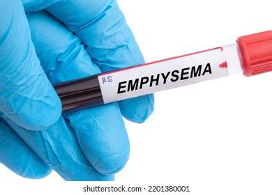 Emphysema Photos