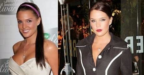 Danielle Lloyd Plastic Surgery Before And After Breast Implants Photos