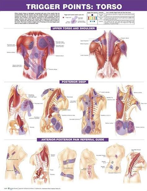 Trigger Points Set Anatomy Poster Two Posters Show Trigger Point