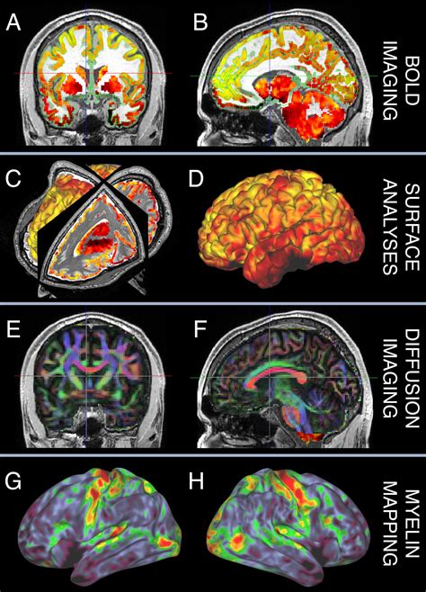 Neuroimaging Acquisition Resources