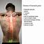 Natural Remedies For Muscle Pain And Inflammation  Top 20