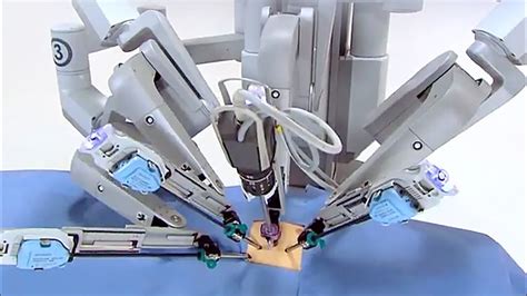 Robotic technology has already touched many areas of medical care, from delivering targeted radiation treatment to assisting surgeons with minimally invasive procedures. Robot Surgeons are the Future of Medicine - YouTube