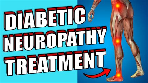 Diabetic Neuropathy Causes Signs And Symptoms Home Remedies Youtube