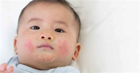 Bagaimana caramu menumbuhkan tinggi badan? Cara Menghilangkan Bintik Merah Pada Kulit Bayi Baru Lahir ...