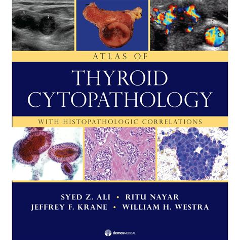 Atlas Of Thyroid Cytopathology With Histopathologic Correlations