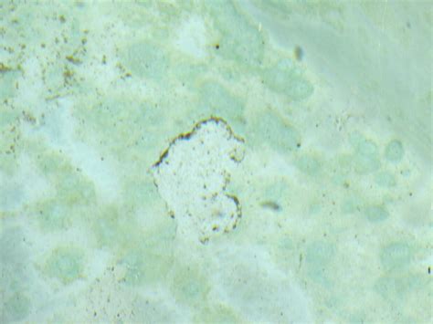 You can repair swimming pool plaster cracks yourself. Cracks In A Pool: Are They Only In The Plaster or Run ...