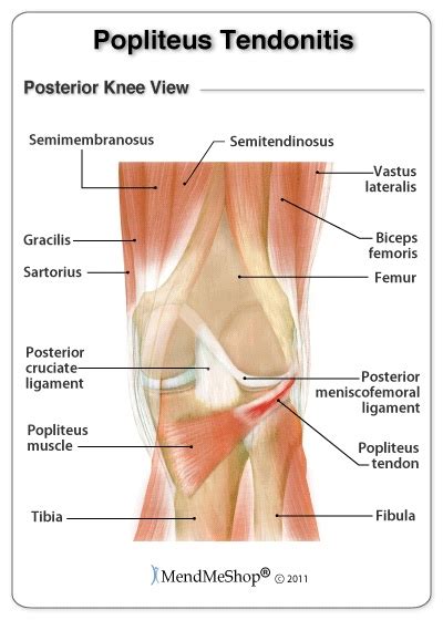 Front leg deformity is a condition that results in disparity of limb length, reduced mobility in joints • what is front leg deformity? Tendinitis in the Knee