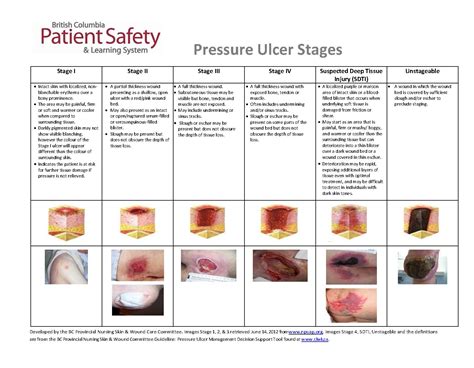 Continuing Education For Pressure Ulcer Prevention Taking The Pressure Off Part At