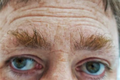 Mens Dos And Donts Of Eyebrow Grooming