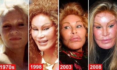 Viral Photos Worst Cosmetic Surgery Disasters Jocelyn Wildenstein A
