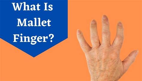 Mallet Finger Causes Symptoms Treatments Of Drop Finger Livlong