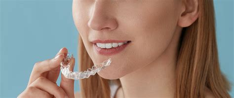 The usual treatment time with ceramic braces. How Long Does Invisalign Take To Straighten Teeth? | Good ...