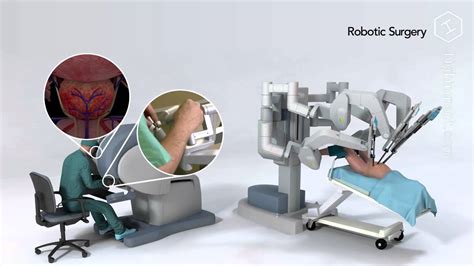 Laparoscopic Radical Prostatectomy