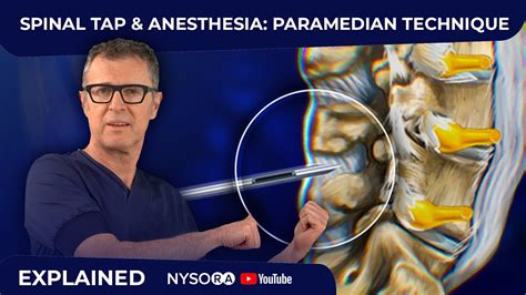 Spinal Tap Anesthesia Paramedian Technique Crash Course With Dr