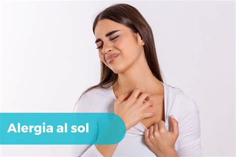 Alergia Al Sol Causas Síntomas Y Tratamiento Doctorisy