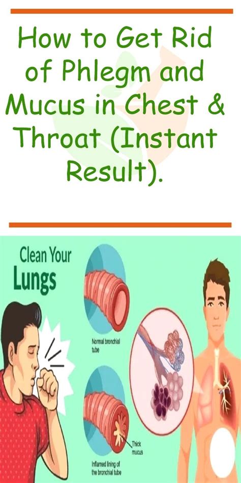 Meds To Get Rid Of Phlegm In Throat