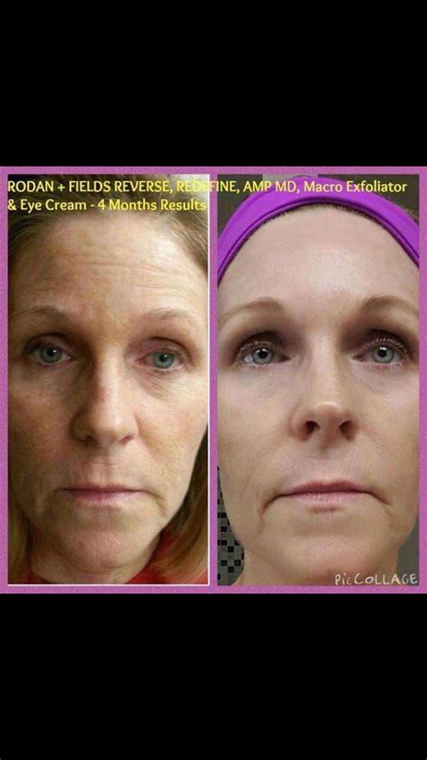 Rodan And Fields Rodan Fields Skin Care Anti Aging Wrinkle Creams