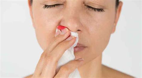 Here Are 9 Home Remedies To Stop Nose Bleeding T H E B N E F I T S Of