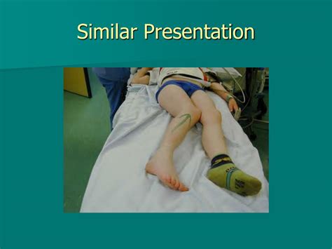 Ppt Shortened And Internally Rotated Right Leg Powerpoint