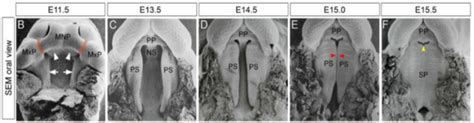 Mouse Palatogenesis Developmental Stages Of The Mice Palate B F