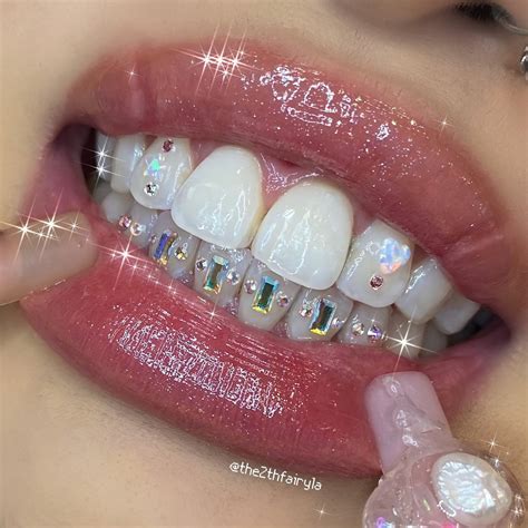 Pin By Adriennah Banda On I Love My Job In Tooth Gem Teeth