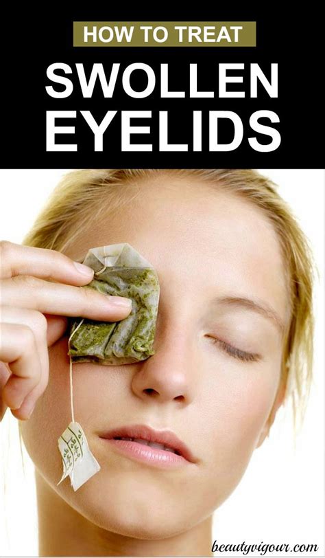 How To Treat Swollen Eyelids Swollen Eyelid Swollen Eye Remedies