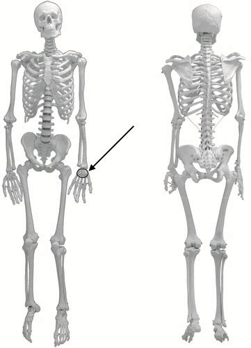 Exercise 5 Appendicular Skeleton Flashcards Quizlet