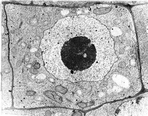 Diagram of animal cell seen under electron microscope. Animal Cell Electron Microscope Labelled