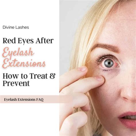 Red Eyes After Eyelash Extensions How To Treat And Prevent