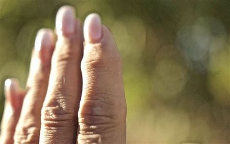 Understanding Arthritis Bump On Finger
