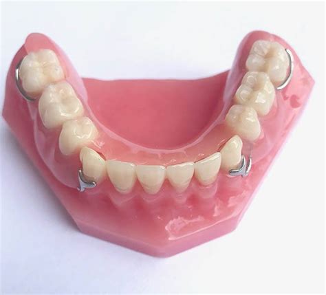 Best Partial Dentures To Restore Your Smile Shelby Dental Center