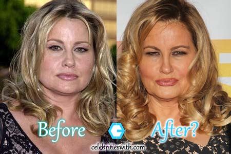 Jennifer Esposito Facelift Plastic Surgery Before And After My Xxx Hot Girl