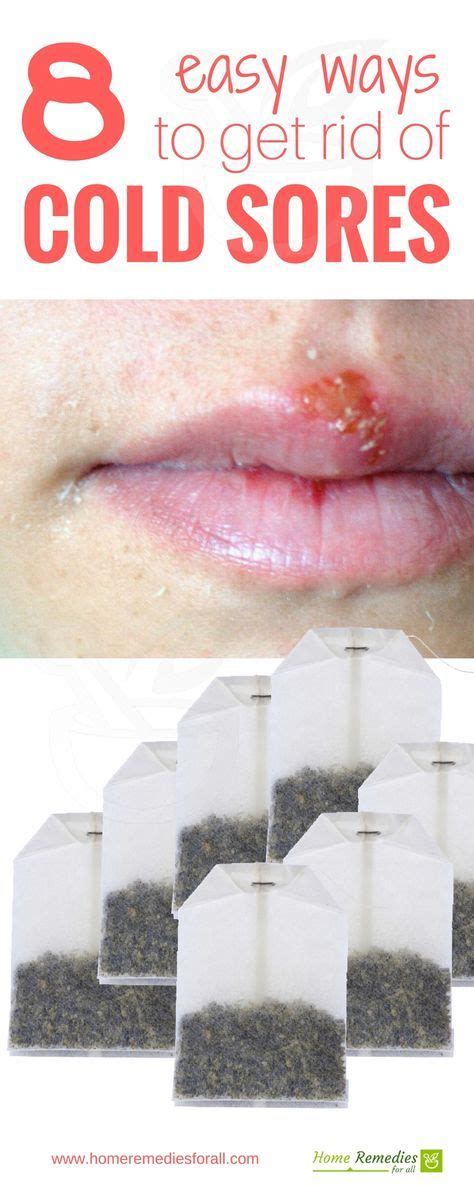 Get Rid Of Cold Sores With 8 Simple But Very Effective Home Remedies Cold Sores Remedies Get