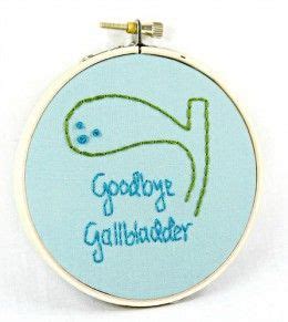 It is used as a temporary storage for bile, a fluid produced in the liver. Tips for Recovering From Laparoscopic Gallbladder Removal Surgery (Cholecystectomy ...