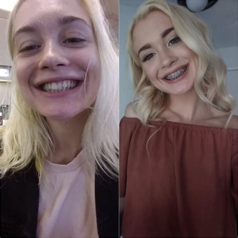 Anastasia Knight 18 Anyone Looking Forward To Some Brace Face And Teen Themed Porn From Her
