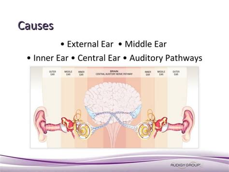 Audiology And Hearing Health Tinnitus Presentation
