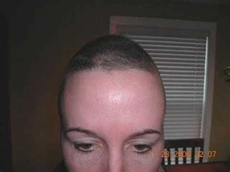 But i don't think you will get long hair within 2 weeks. Hair Growth Show Starting 6 Weeks After Chemo - YouTube